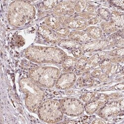 Caldesmon/CALD1 Antibody, Novus Biologicals:Antibodies:Primary Antibodies